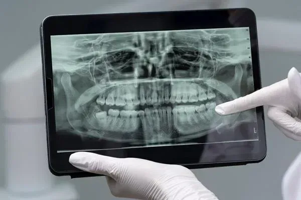 Panoramic X-Ray Using by Dentist At Towne Centre