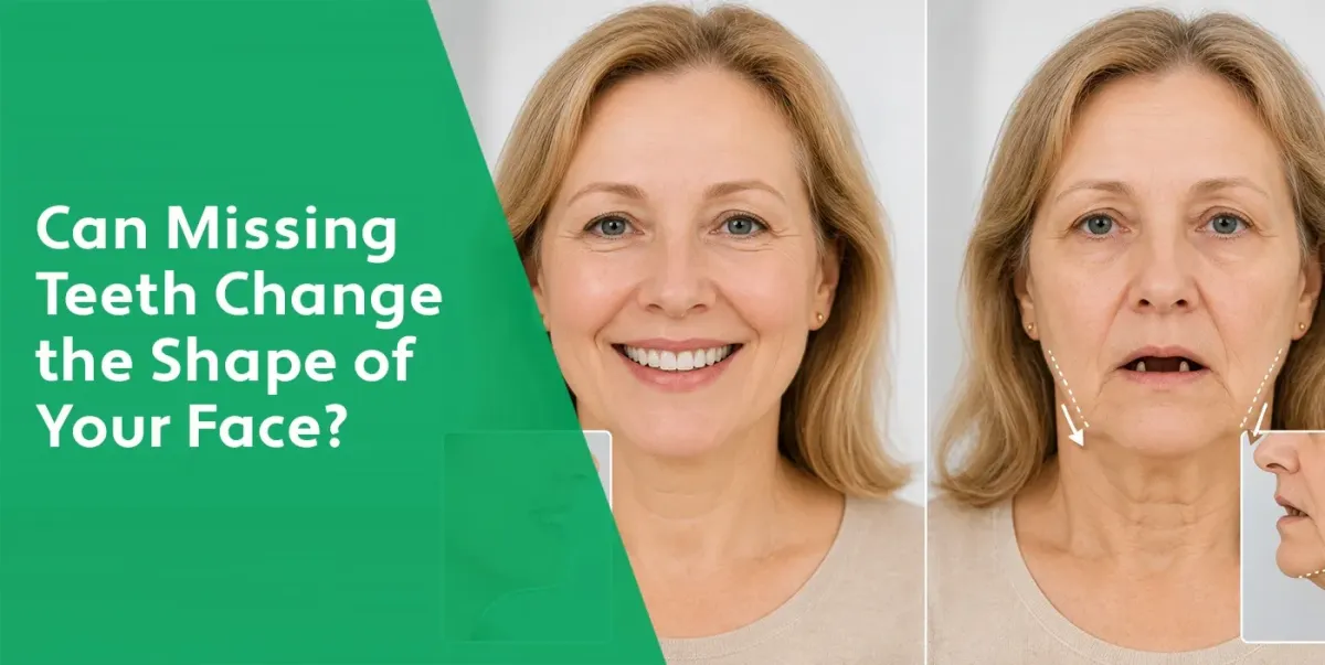 Can Missing Teeth Change the Shape of Your Face? | West Chester Dentist
