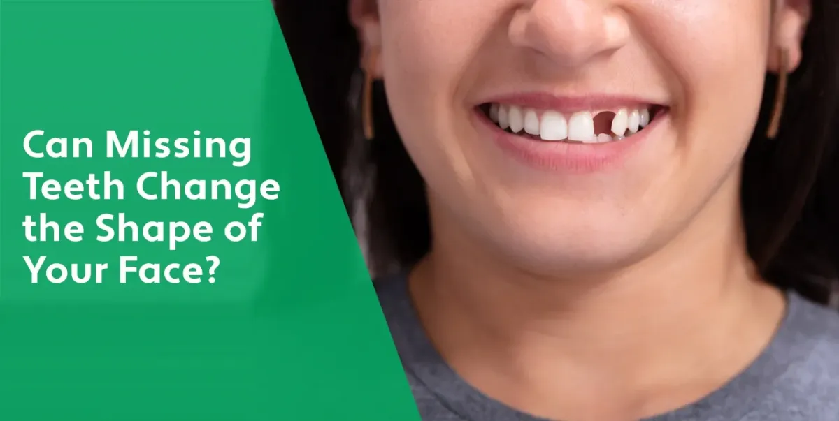 Can Missing Teeth Change the Shape of Your Face? | West Chester Dentist