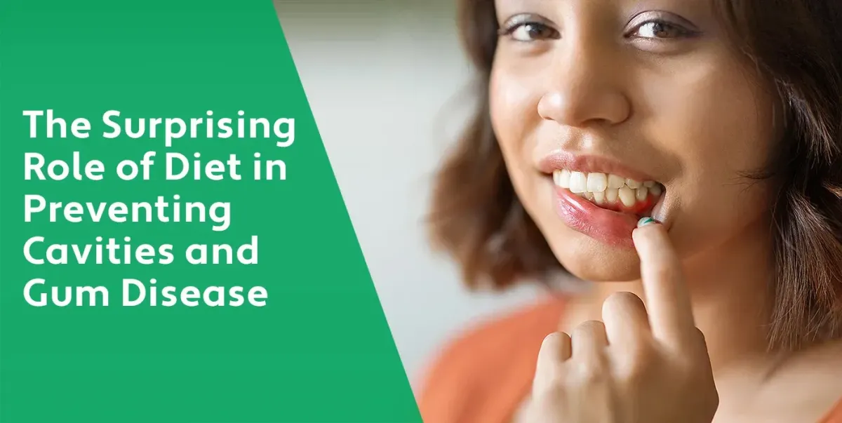The Surprising Role of Diet in Preventing Cavities and Gum Disease | West Chester OH