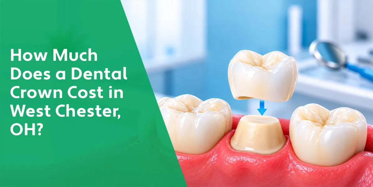 Dental Crown Cost in West Chester, OH | Price Guide