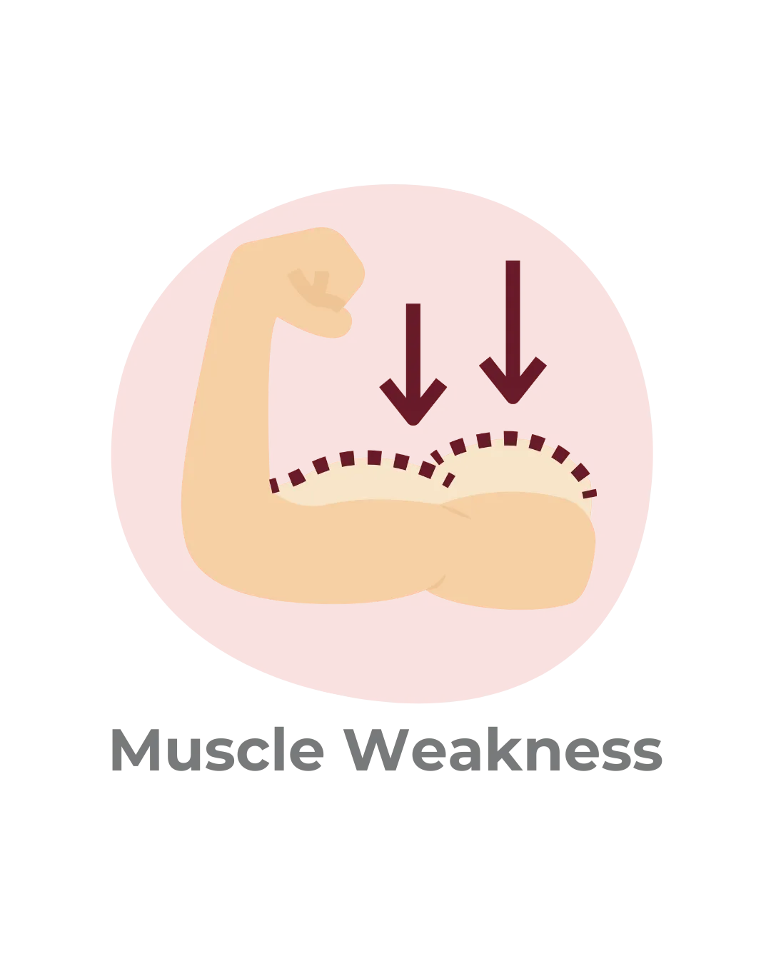 arm showing muscle weakness caused by neuropathy
