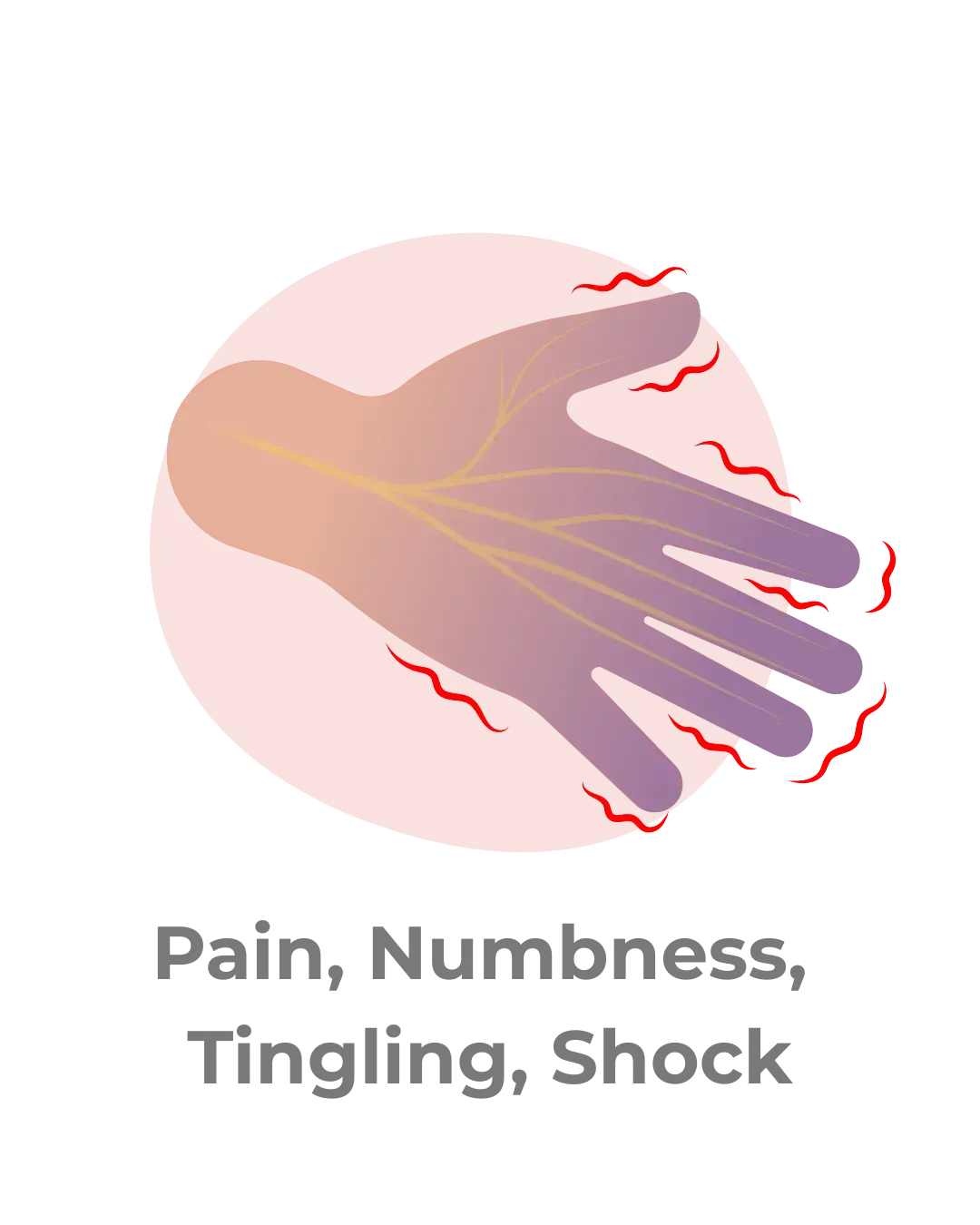 hand showing nerve pain, numbness, and tingling symptoms
