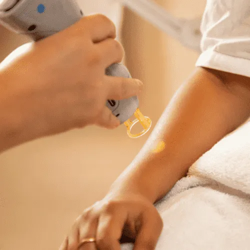 A lady with hand pain relieving pain with cold laser therapy