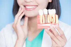 dental-pv-dental-implants