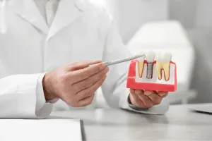 dental-pv-dental-rehabilitation