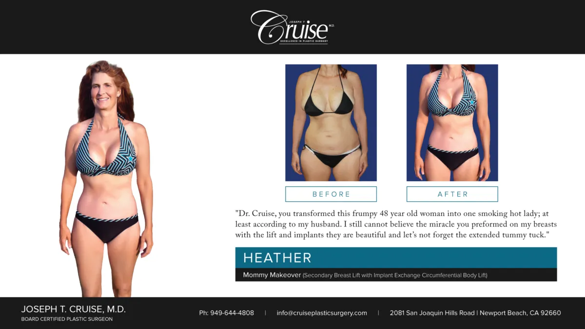 Heather - Client Testimonial