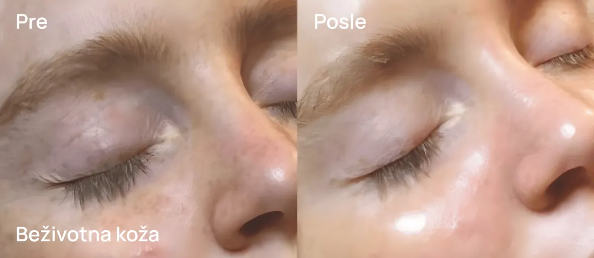 MedSpa rezultat - pre i posle