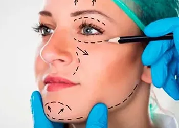 Cirugía Facial