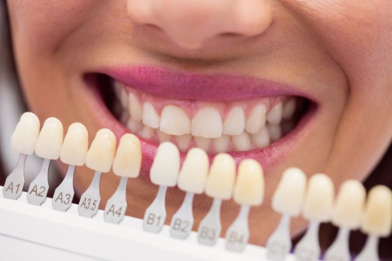 Cosmetic Dentistry in Trivandrum