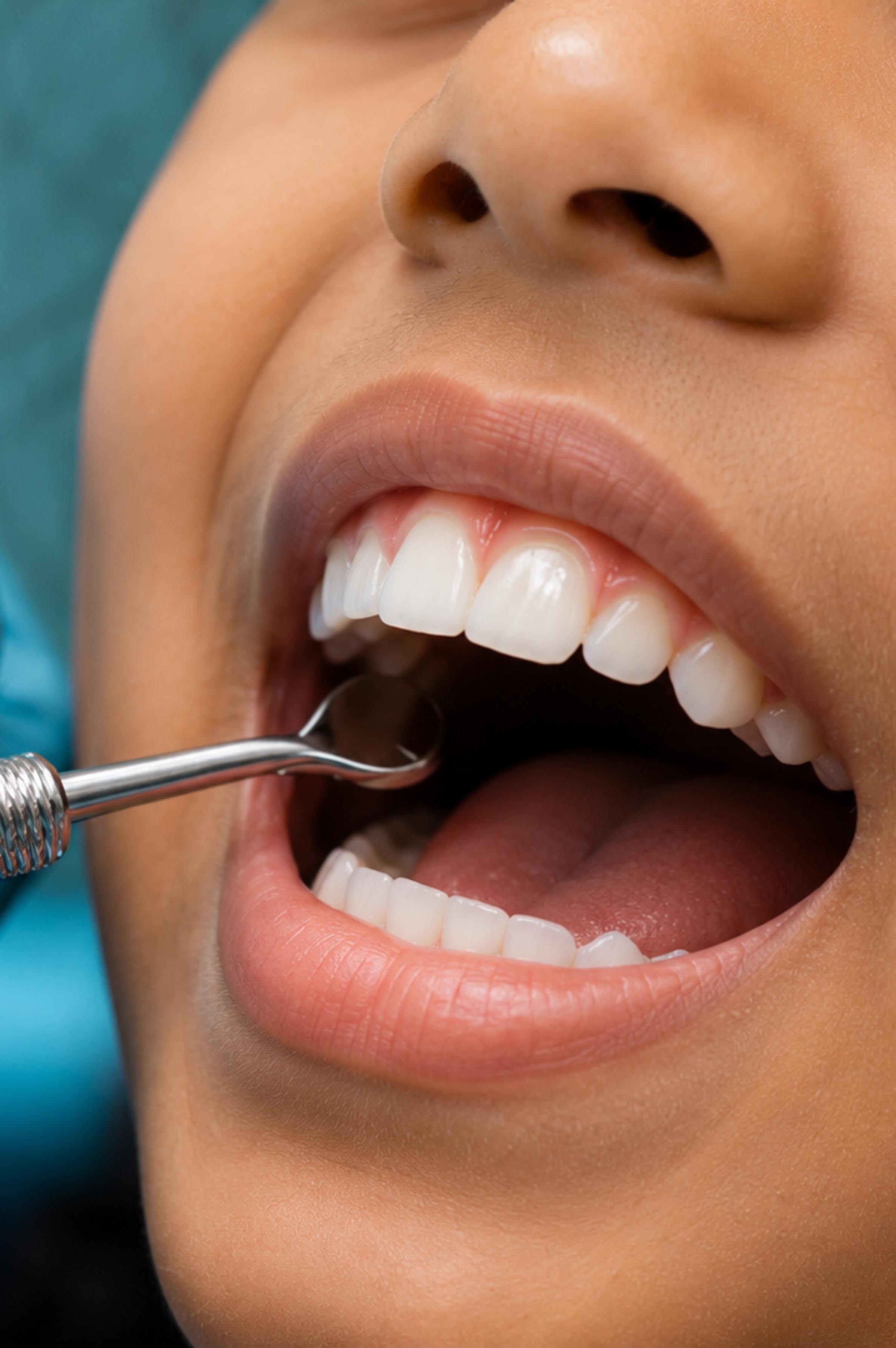 Child Dental Care in Trivandrum