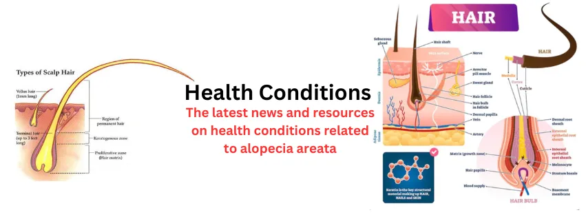 health conditions