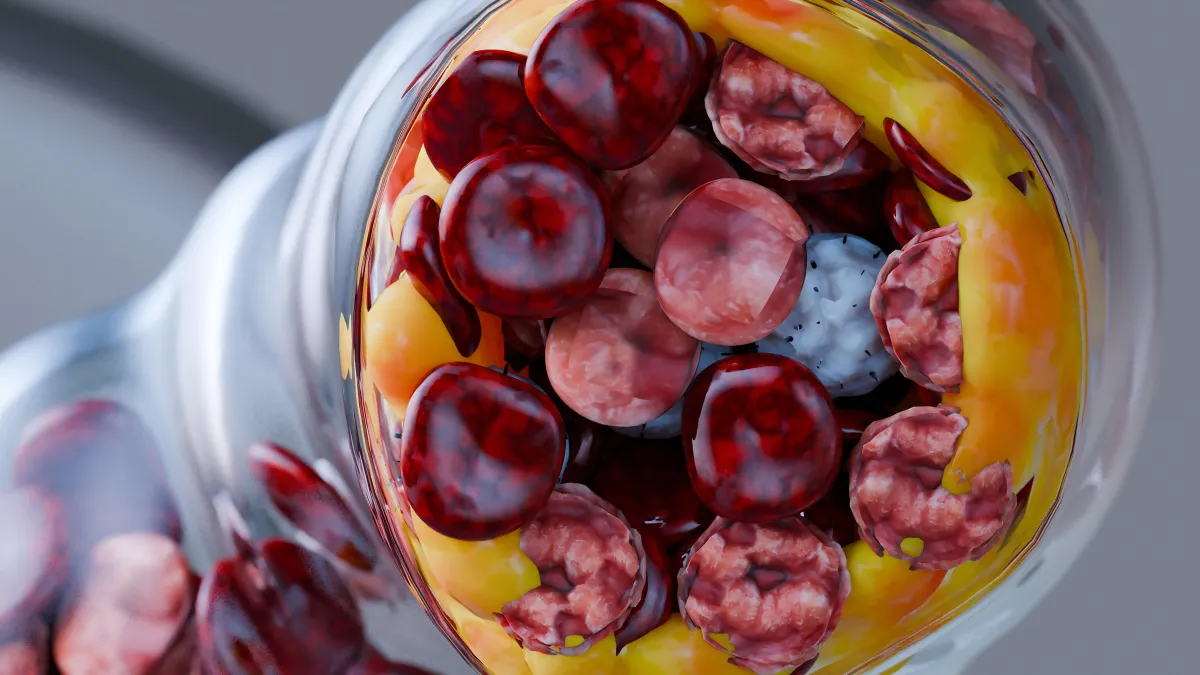 Hyperlipidemia