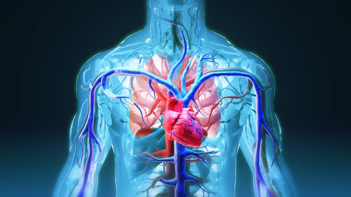 Coronary Artery Disease