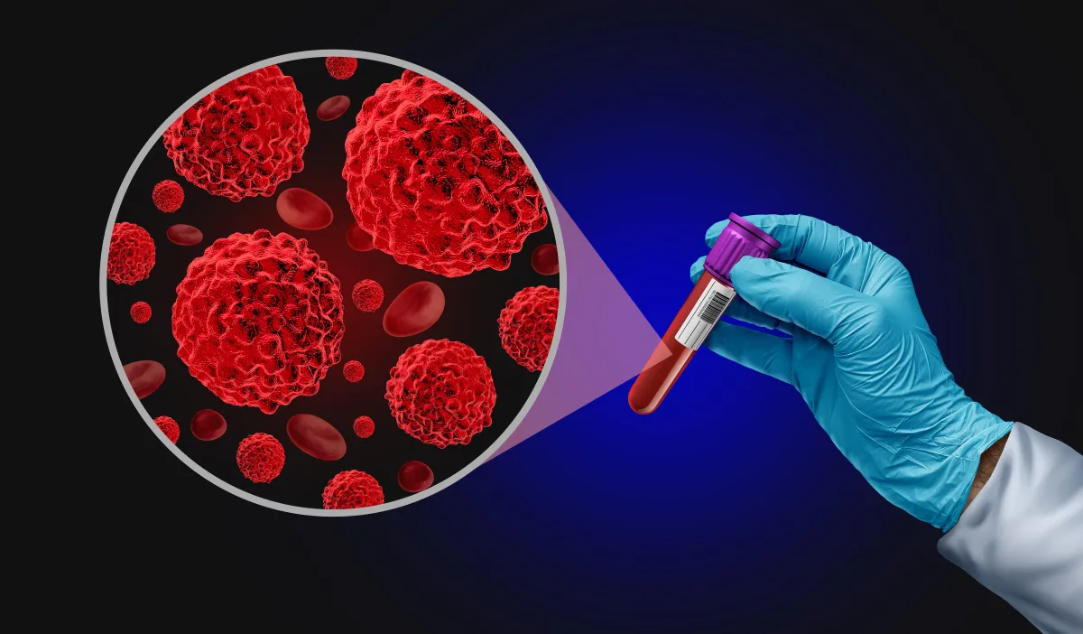 Cancer Screening