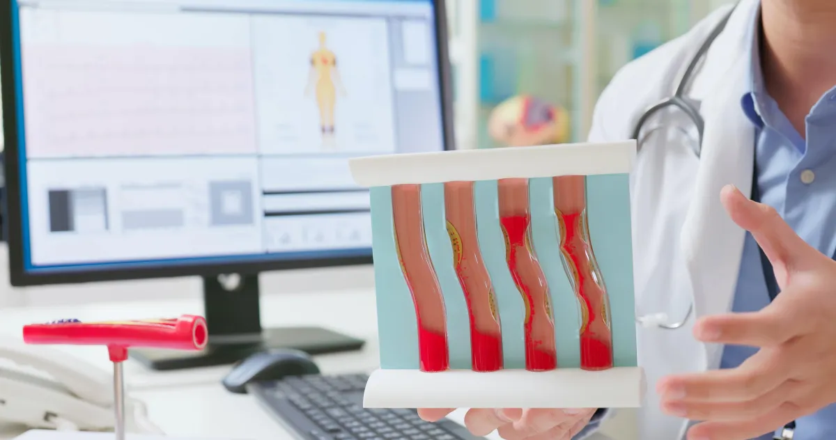 Coronary Artery Disease (CAD)