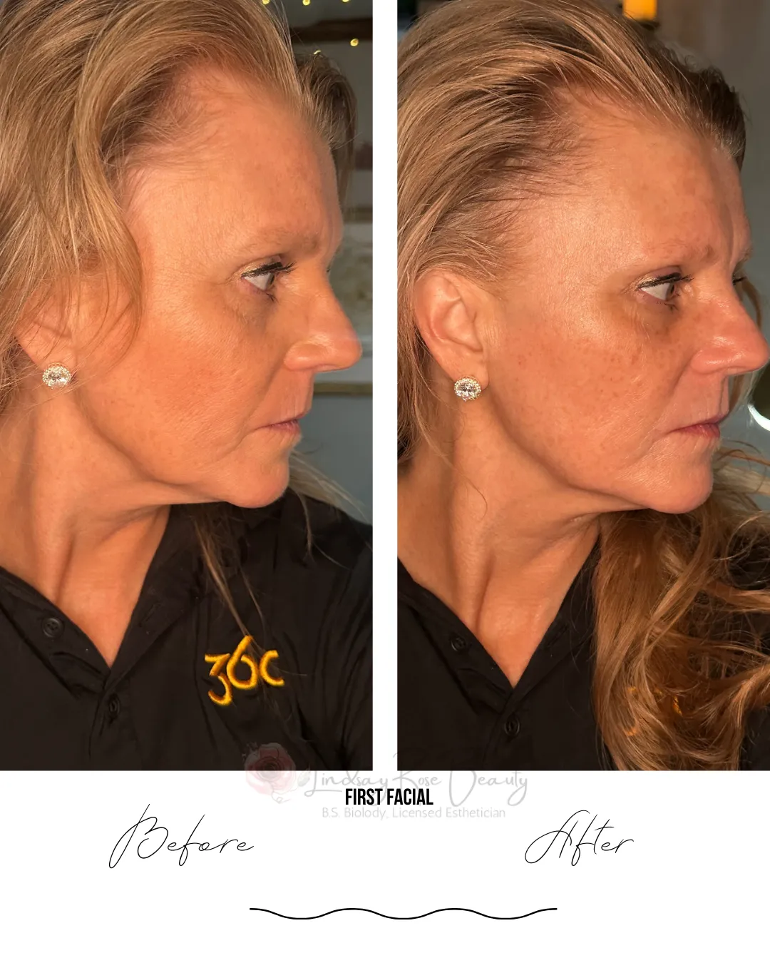 picture of woman demonstrating peeling off the needle free filler facial mask by Lindsay Rose Ali at Lindsay Rose Beauty in Mansfield, Texasf