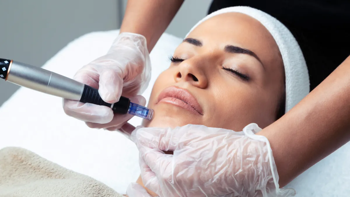 Microneedling- microace pentru hidratare & nutritie.