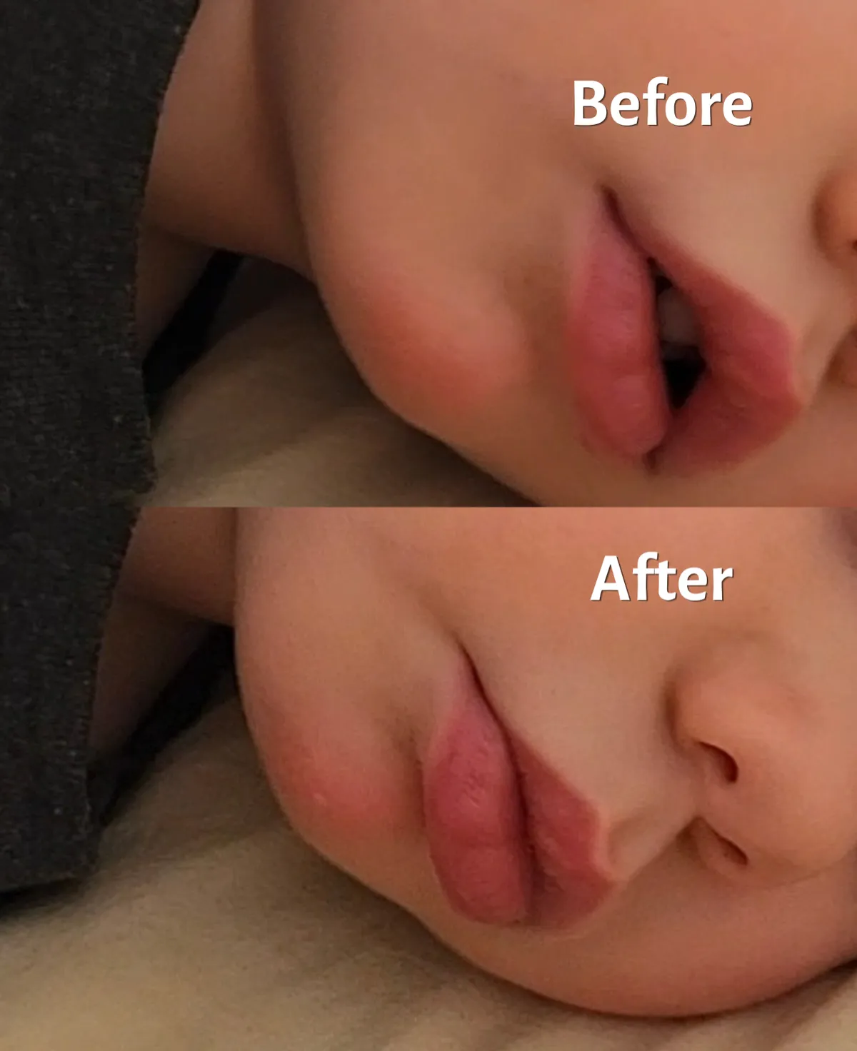 How To Get Baby’s Tongue On The Roof of The Mouth