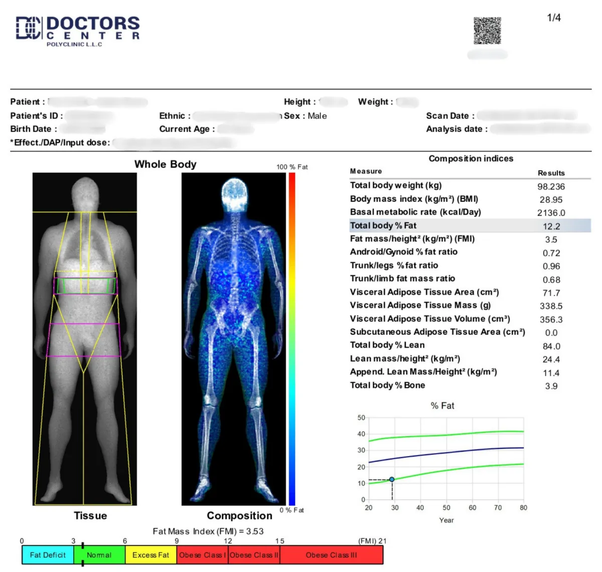 Using the most accurate body scan to measure your progress