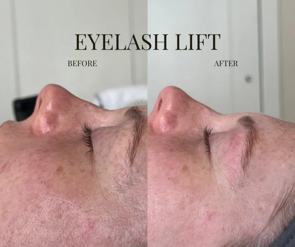 eyelash lift before and after ashburn va