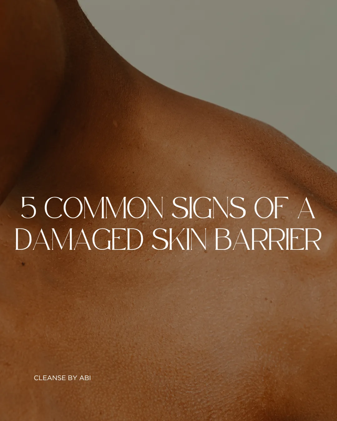 5 Common Signs of a Damaged Skin Barrier cover image