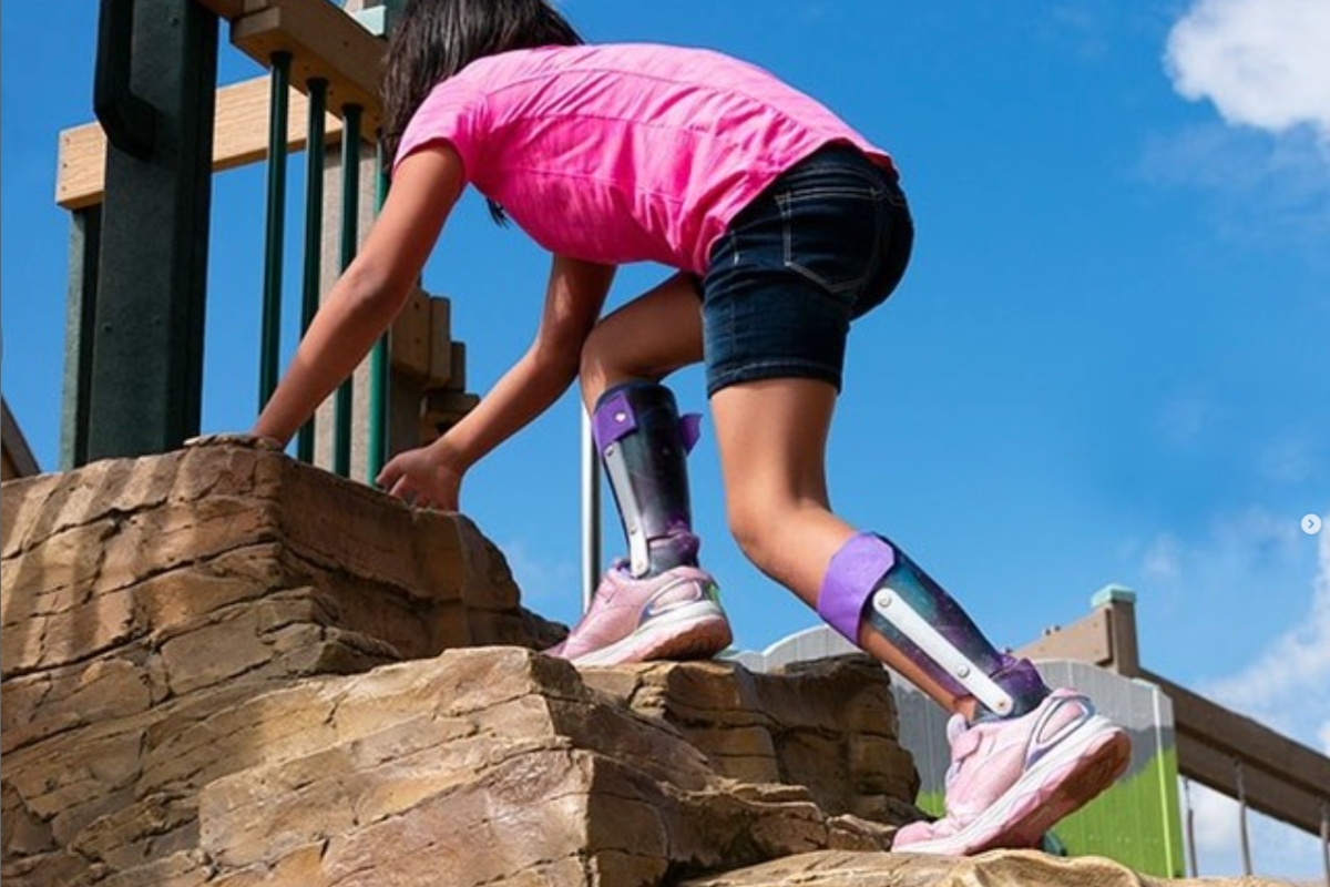 Child climbing on a playground wall with orthotic braces on both legs, illustrating how orthotics support mobility and alignment.
