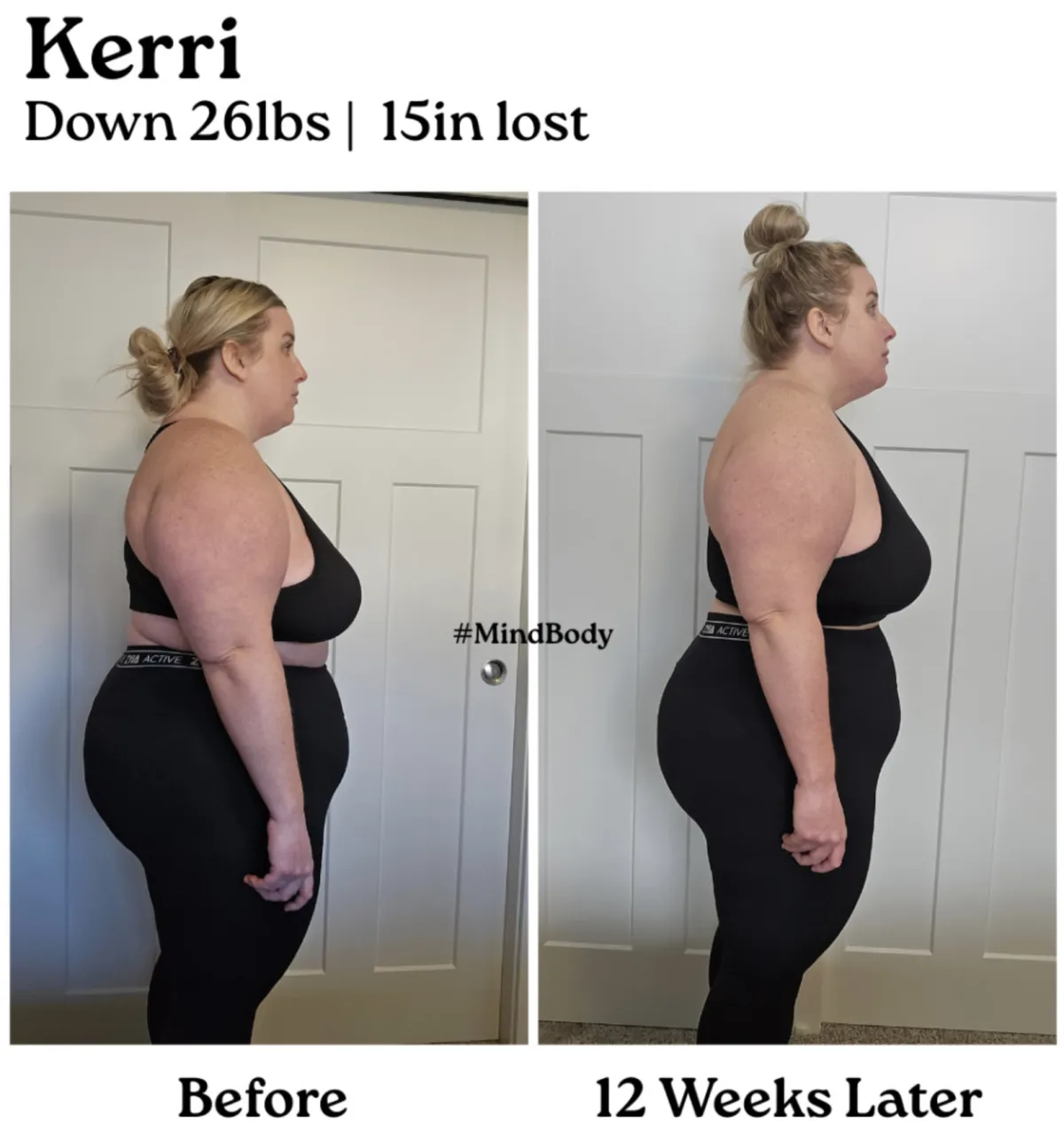 Side-by-side before and after photos of a woman in a red patterned bikini. The before image shows her standing sideways with a visibly fuller midsection; the after photo shows a noticeable reduction in belly fat and overall slimmer profile.