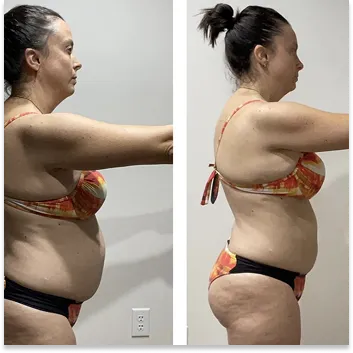 Side-by-side before and after photos of a woman in a red patterned bikini. The before image shows her standing sideways with a visibly fuller midsection; the after photo shows a noticeable reduction in belly fat and overall slimmer profile.