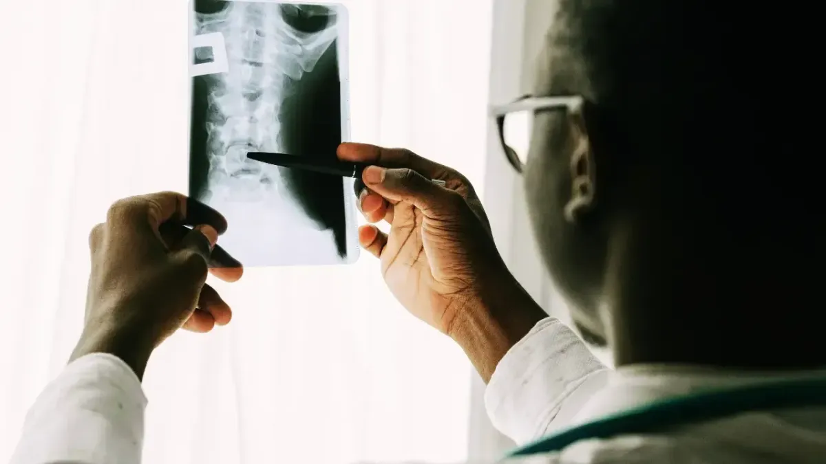 A chiropractor examining an anterior-posterior spinal X-ray film with a pen to analyze alignment for localized spine health care in Fort Mill, SC.