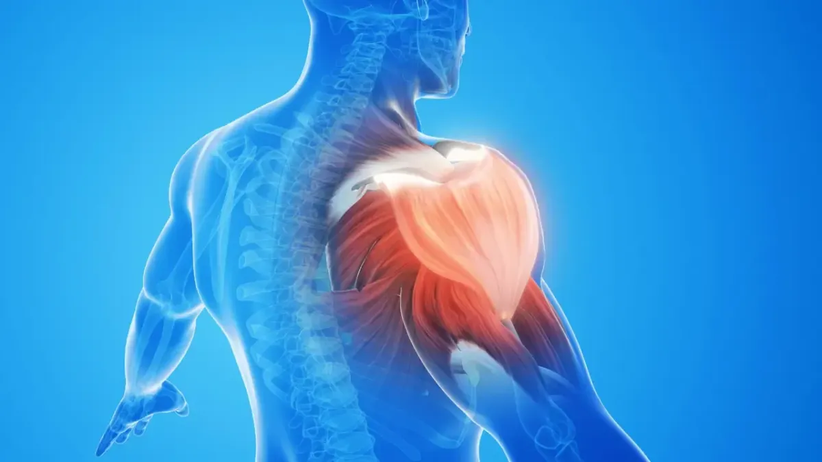 A 3D medical illustration showing a glowing orange inflamed shoulder joint and musculature, representing anatomical areas addressed with frozen shoulder treatment in Fort Mill, SC.