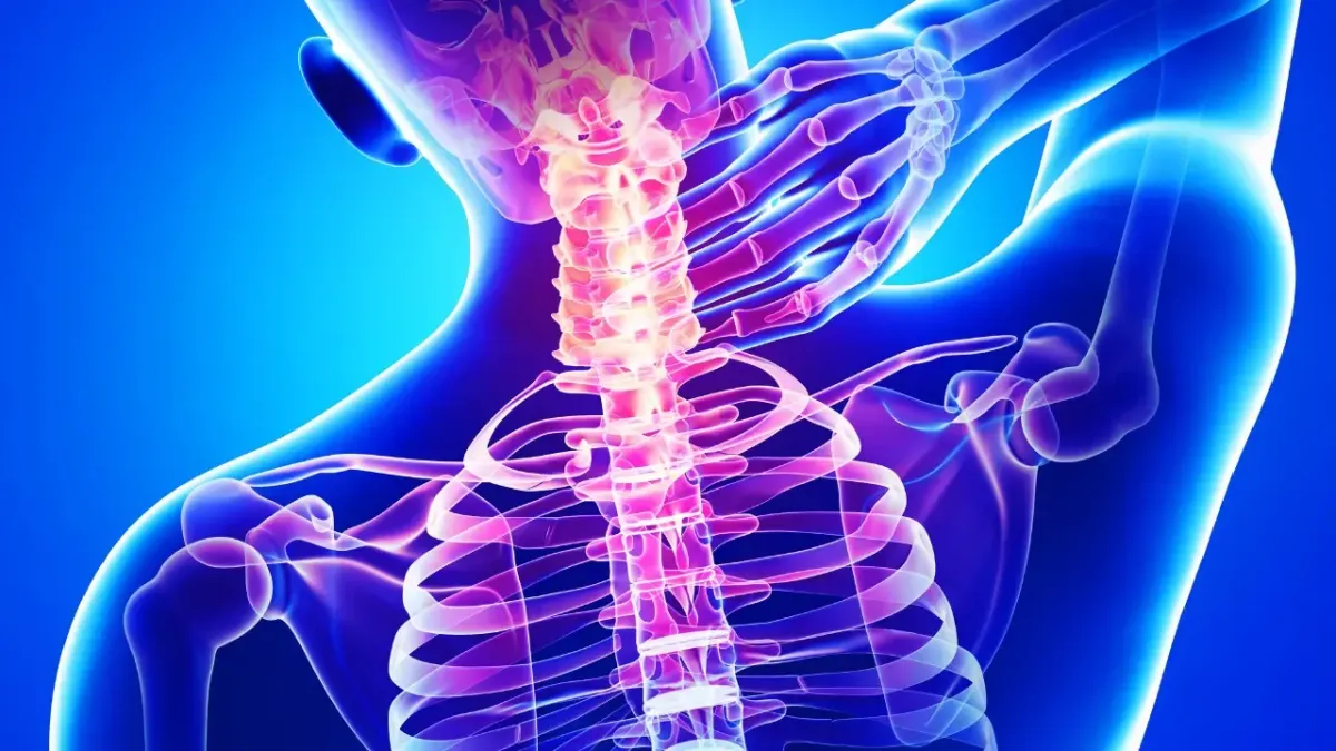 3D medical illustration highlighting cervical spine misalignment and neck pain causing migraines, treated at a Fort Mill SC chiropractic clinic.