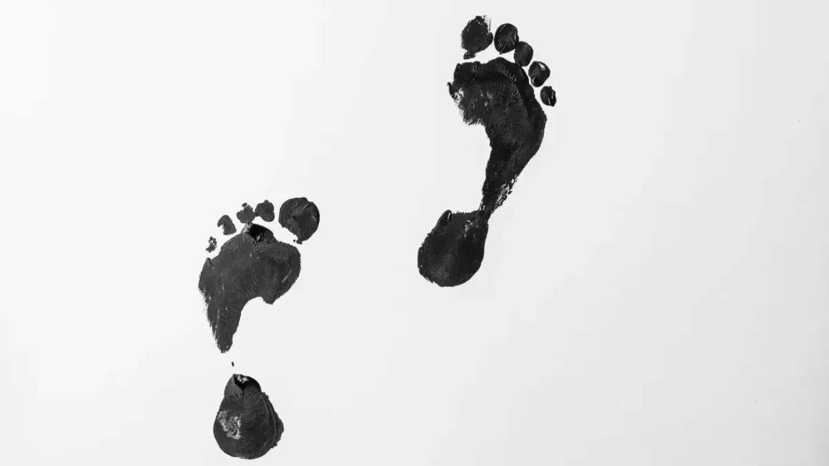 Black ink footprints illustrating the structural difference between a normal arch and flat feet or fallen arches, diagnosed by a chiropractor in Fort Mill SC.