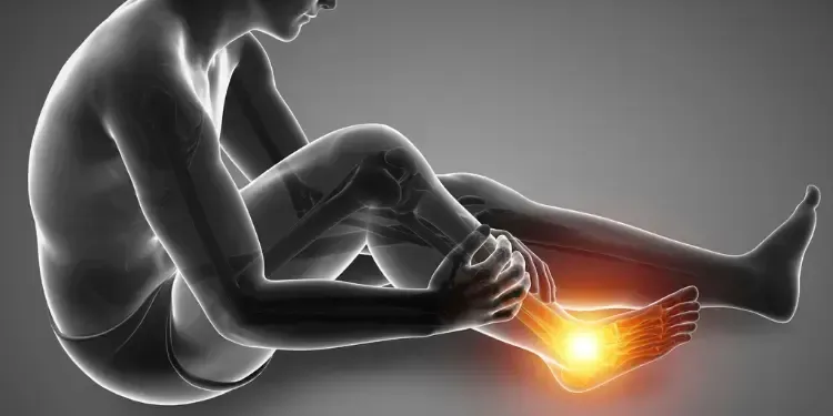 Anatomical illustration of heel pain and foot inflammation evaluated for chiropractic care for plantar fasciitis in Fort Mill, SC.