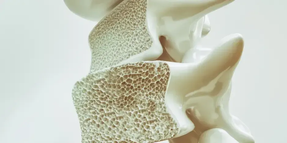 Cross section diagram of human vertebrae showing spine health and low bone density from osteoporosis in Fort Mill SC.