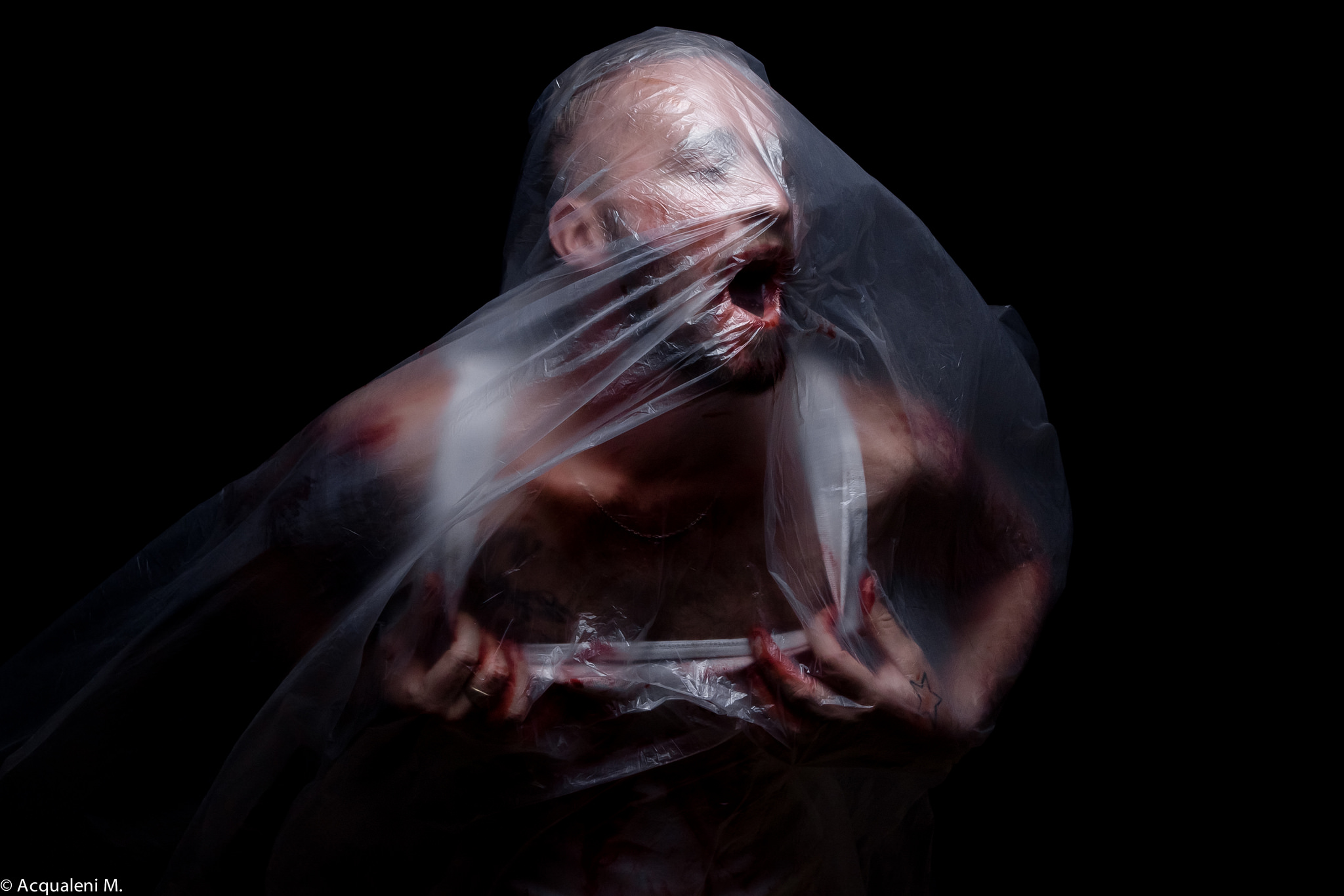 Asphyxia