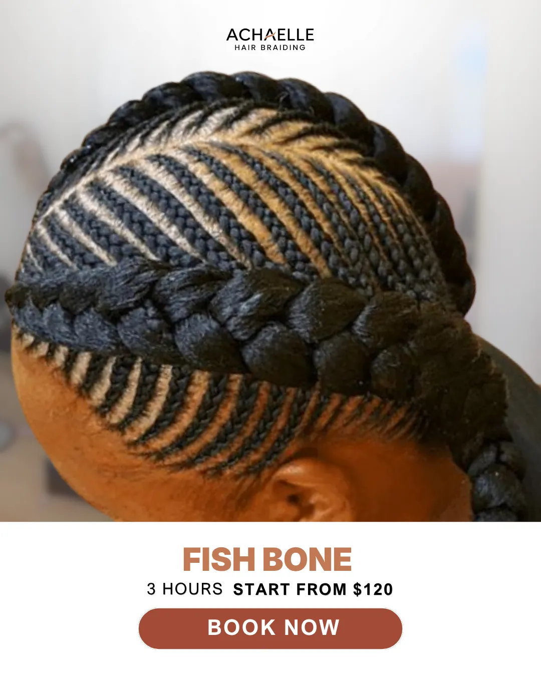 FISH BONE