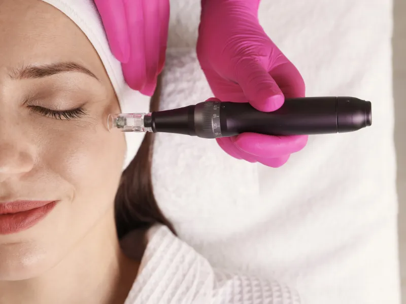 Microneedling, radio frequency, cool jet plasma, and Ultherapy Prime.