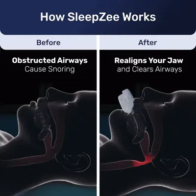 Introduction SleepZee