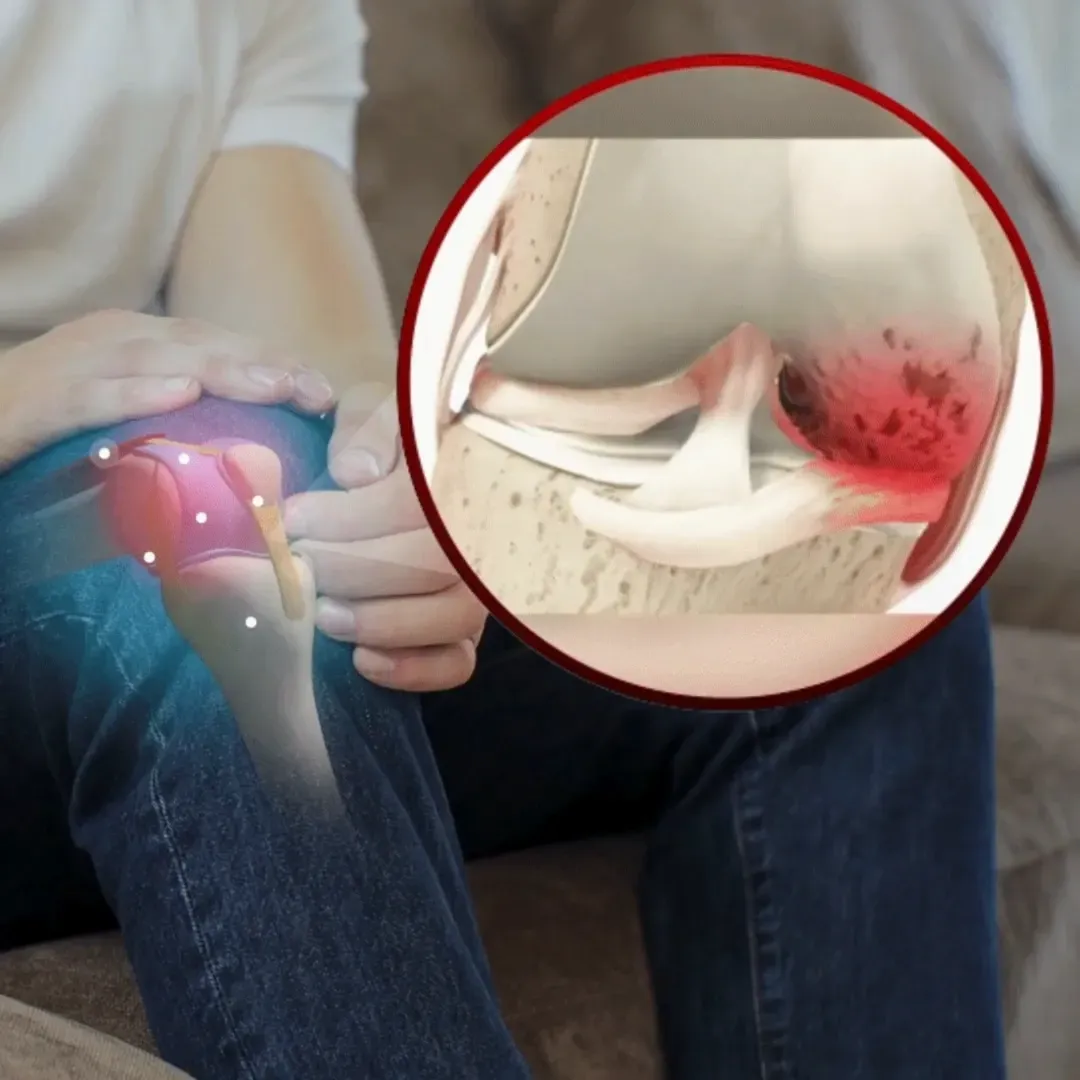 Compressa Knee Stiff