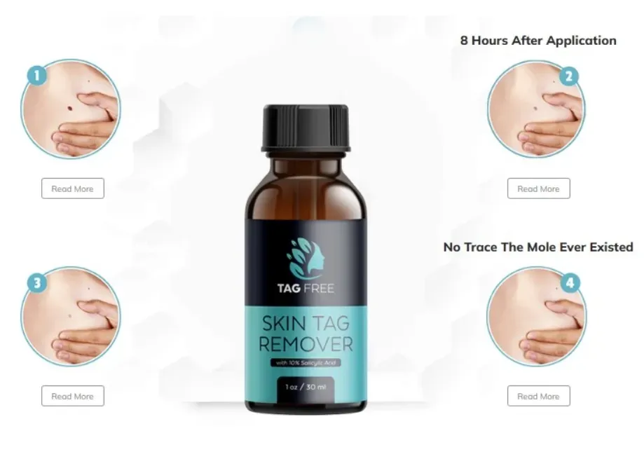 what is TagFree Skin Tag Remover