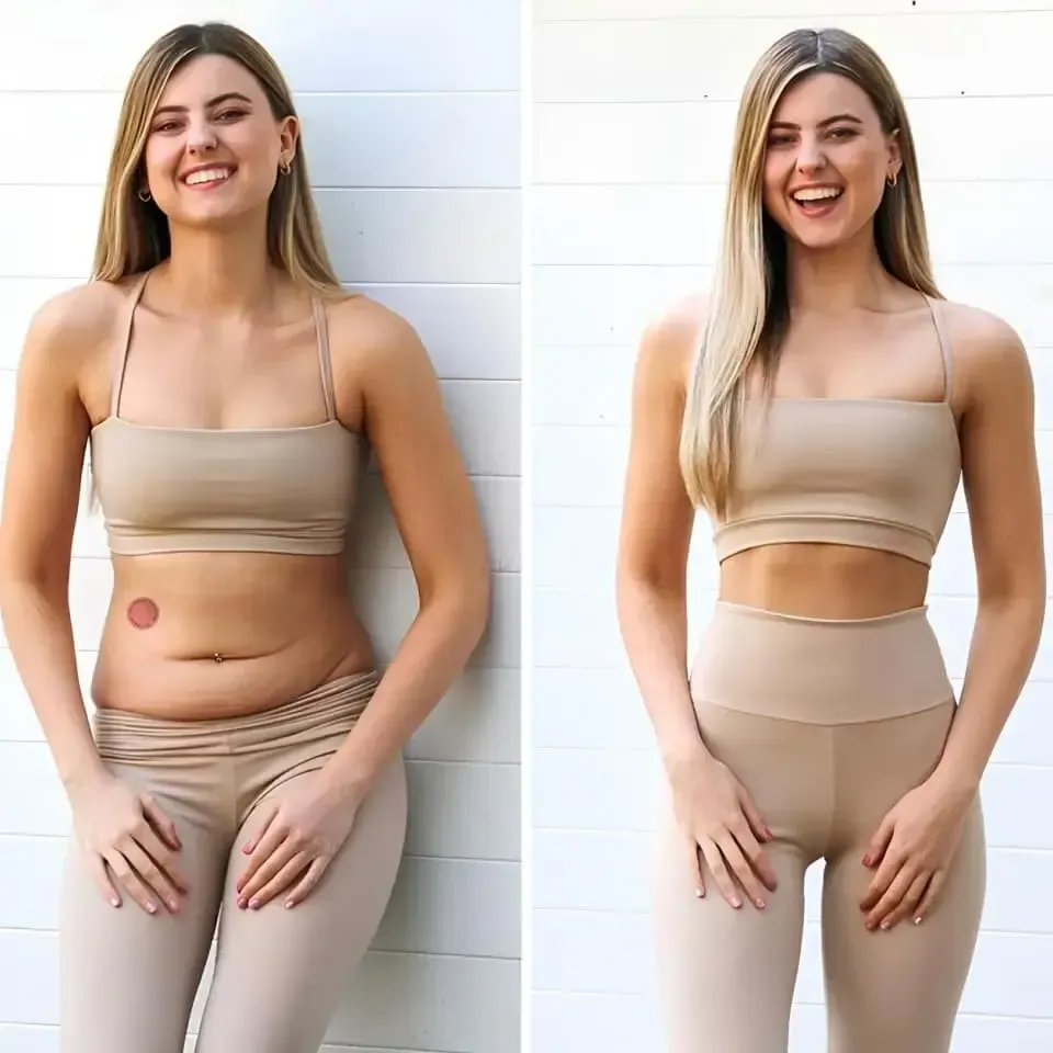 NuraPatch GLP-1 Promote