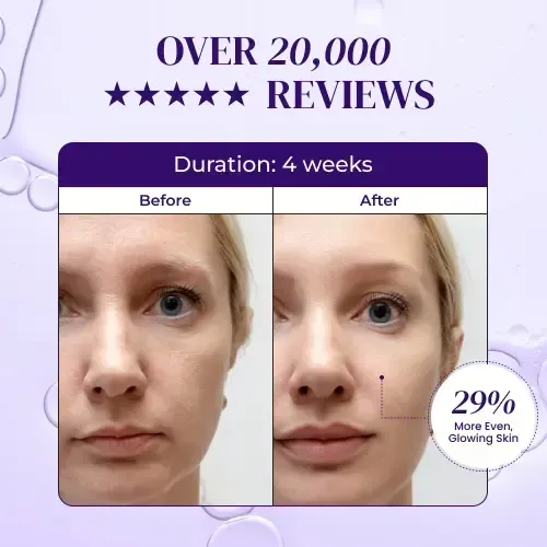 Introduction NuraDerma Mask