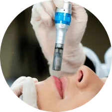 Hydra y Color Lips Minerva Estetic