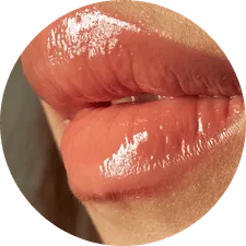 Hydra Lips Minerva Estetic