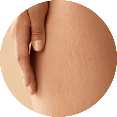 ¿Para qué sirve la micropuntura?