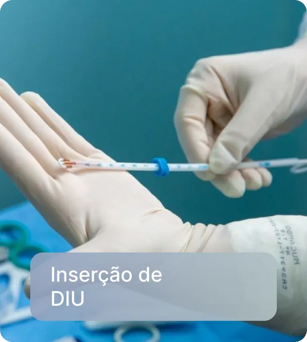 Inserção de DIU