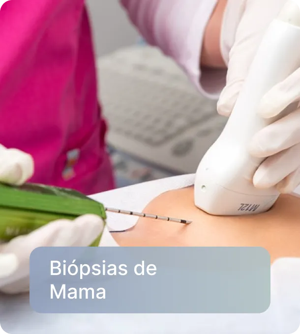 Biópsias de Mama