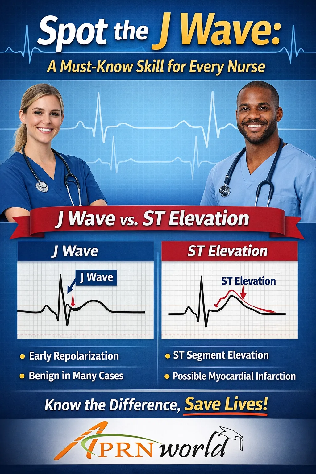 Poster showing J wave vs ST elevation on ECG with labeled examples for nurses and APRN World branding