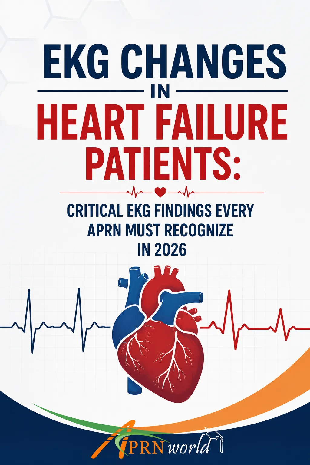 EKG tracing displaying common heart failure findings including atrial fibrillation, left bundle branch block, prolonged QRS duration, and ventricular remodeling changes.